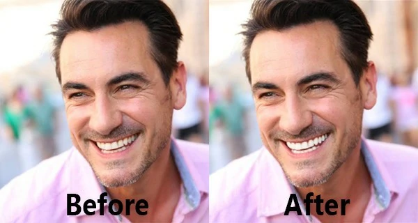 Teeth whiten final result