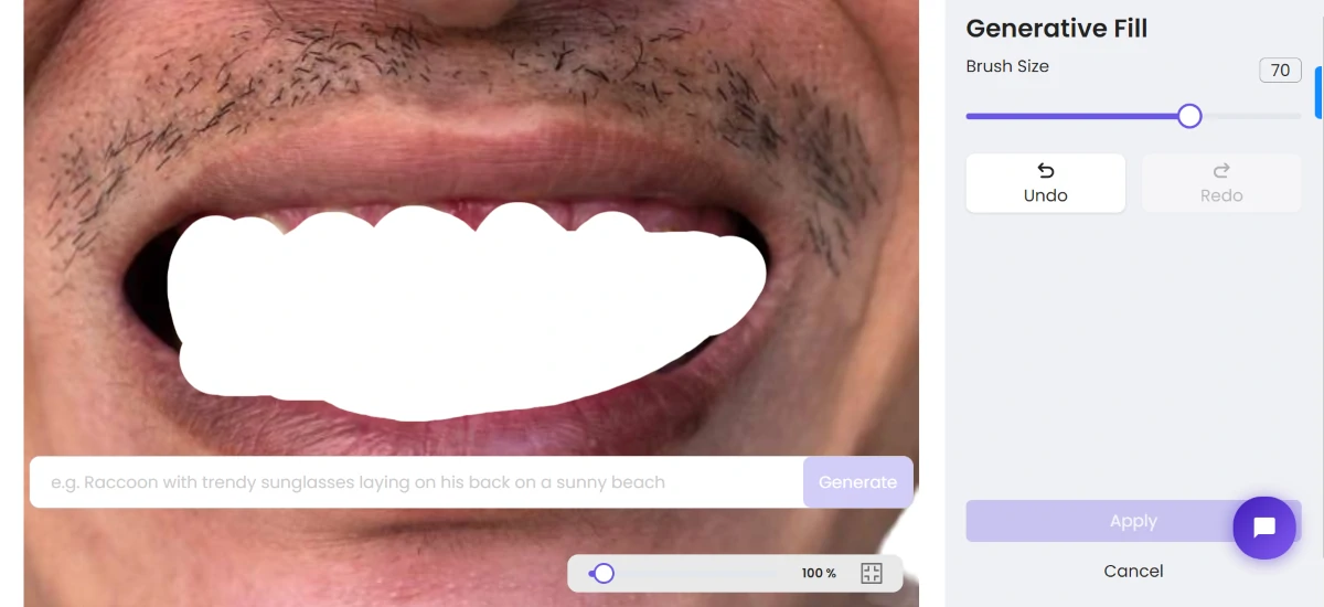 ZMO teeth whiten process 4