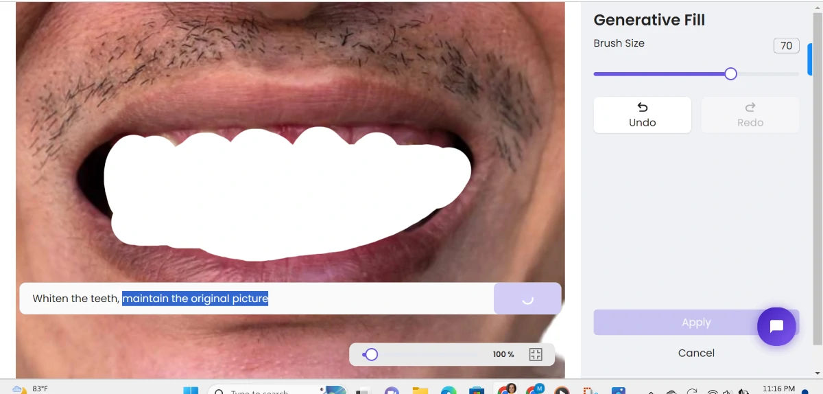 ZMO teeth whiten process 5