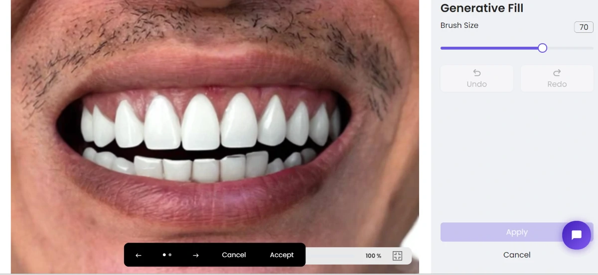 ZMO teeth whiten process 6