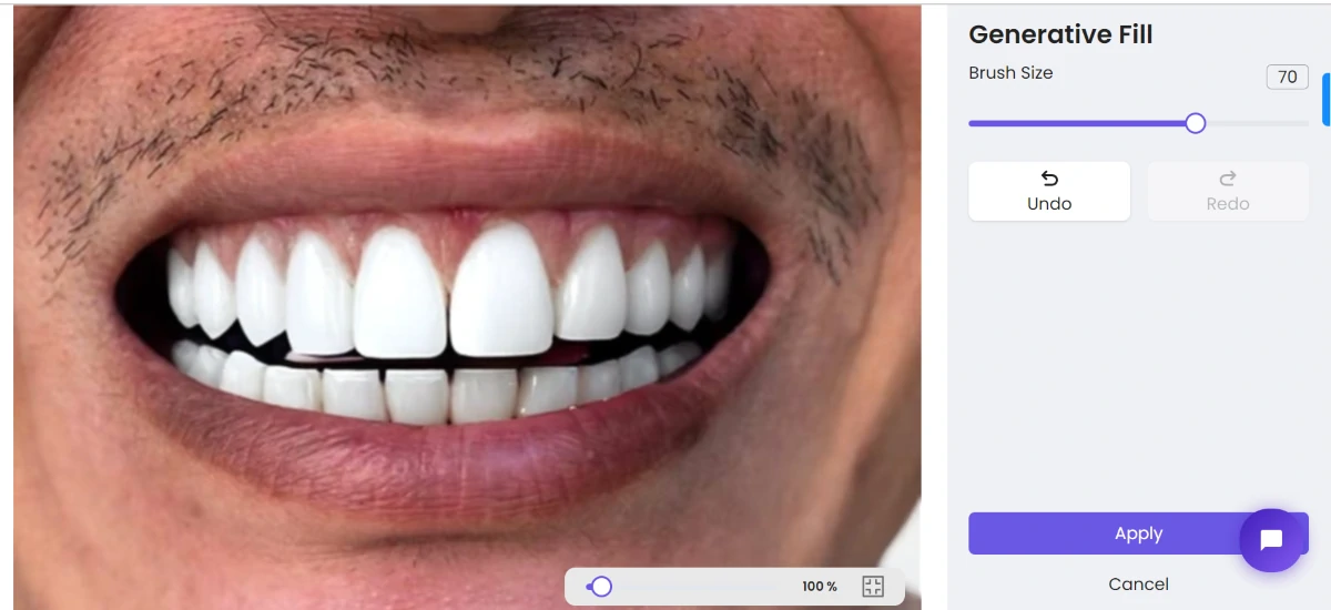 ZMO teeth whiten process 8