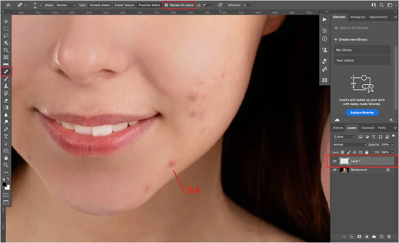 Step 5: Remove the Blemish: